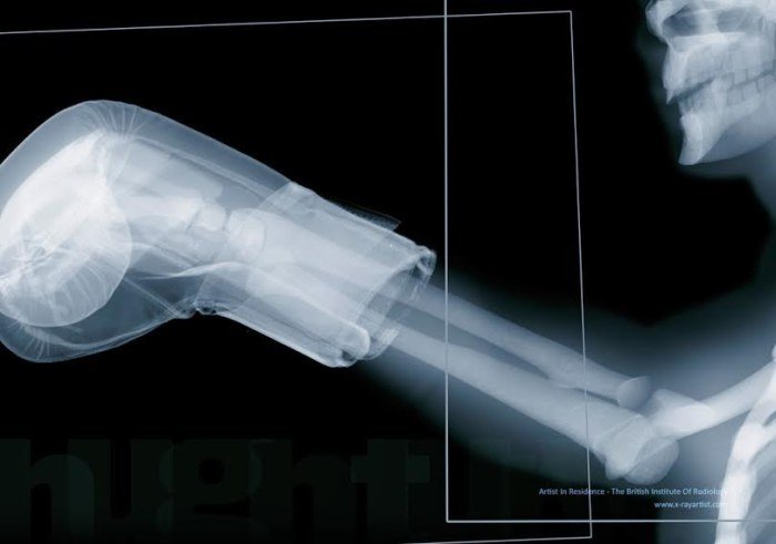 Люди в рентгеновских лучах (14 фото)
