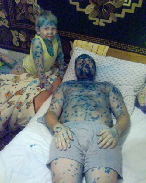 Эх ветрянка-ветряночка)