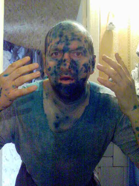 Эх ветрянка-ветряночка)