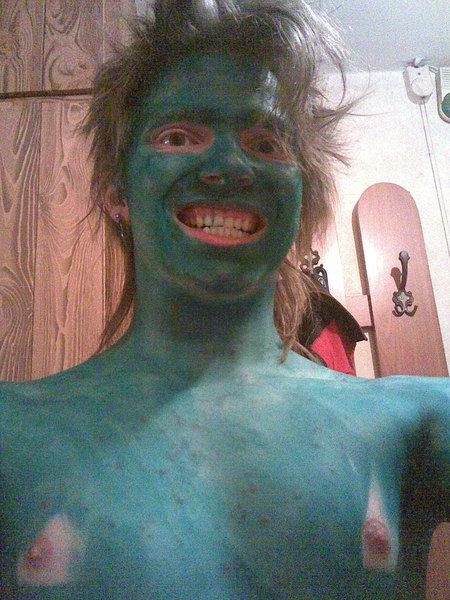 Эх ветрянка-ветряночка)