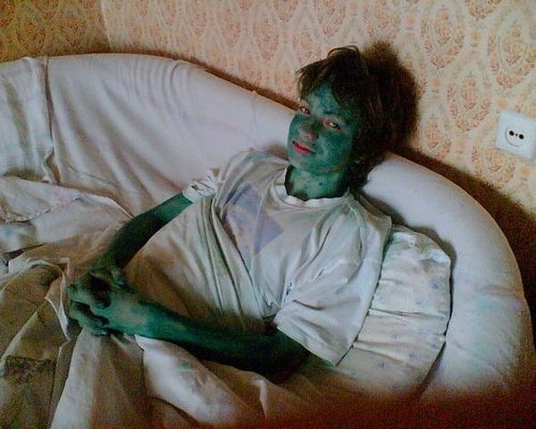 Эх ветрянка-ветряночка)