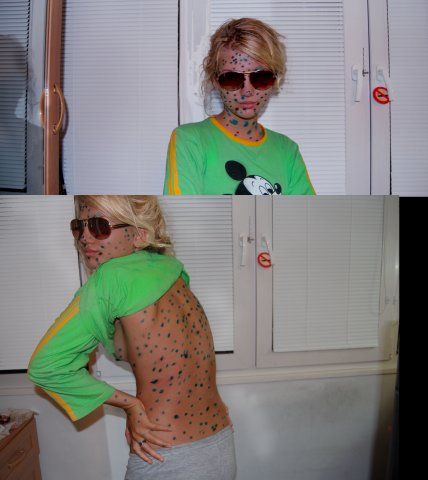 Эх ветрянка-ветряночка)