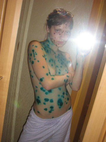 Эх ветрянка-ветряночка)