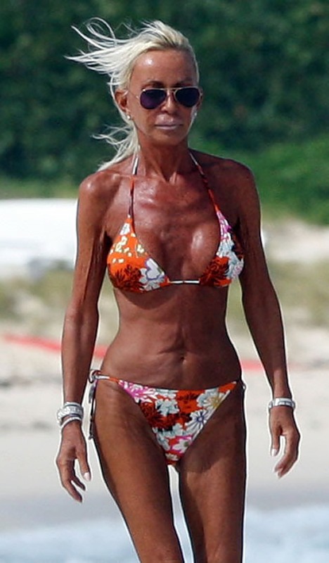 Одни из последствий пластики