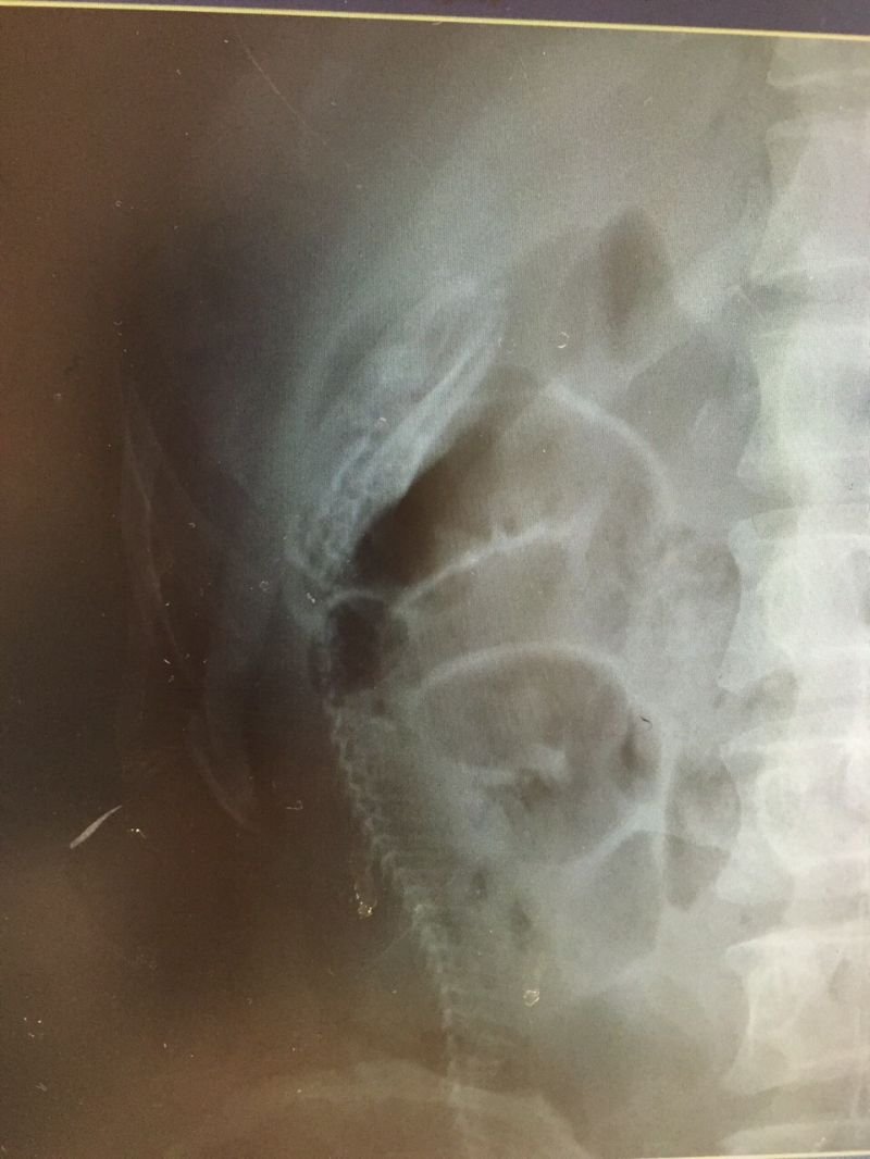 Разгляди на рентгеновском снимке позвоночник угря (18+)