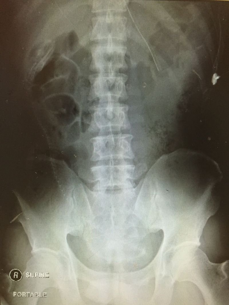 Разгляди на рентгеновском снимке позвоночник угря (18+)