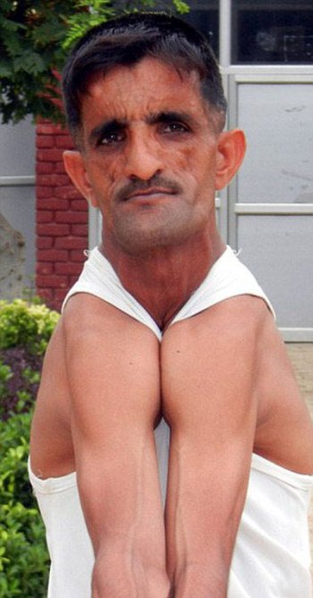 «Резиновый человек» из Индии побил собственный рекорд (6 фото)