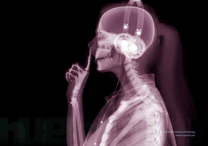 Люди в рентгеновских лучах (14 фото)