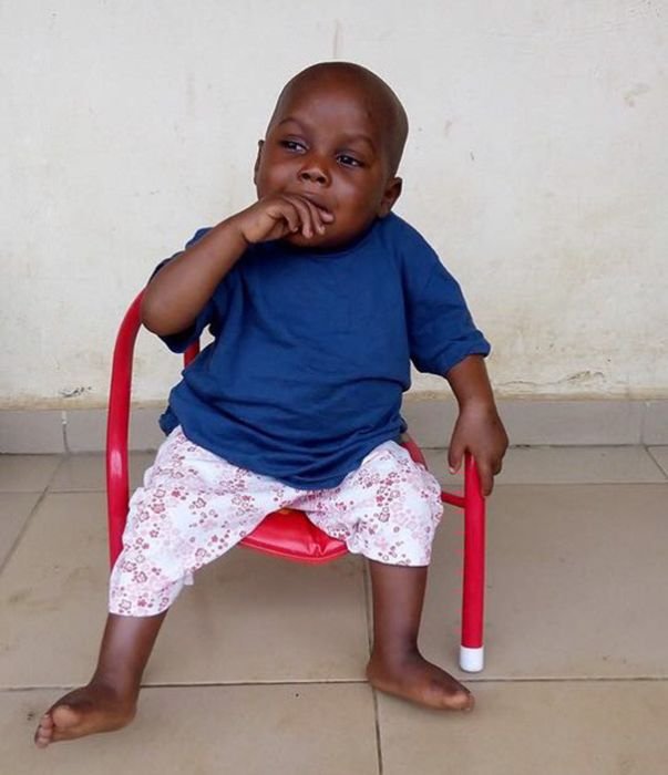 Бездомный мальчик страдавший от недоедания пошел на поправку
