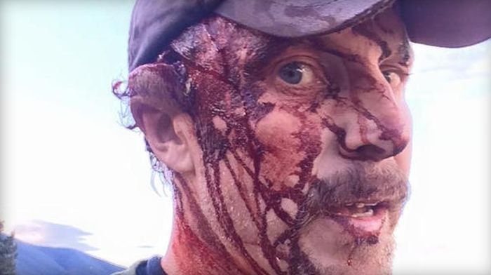 Шокирующие фото, американский охотник чудом выжил после нападения на медведей