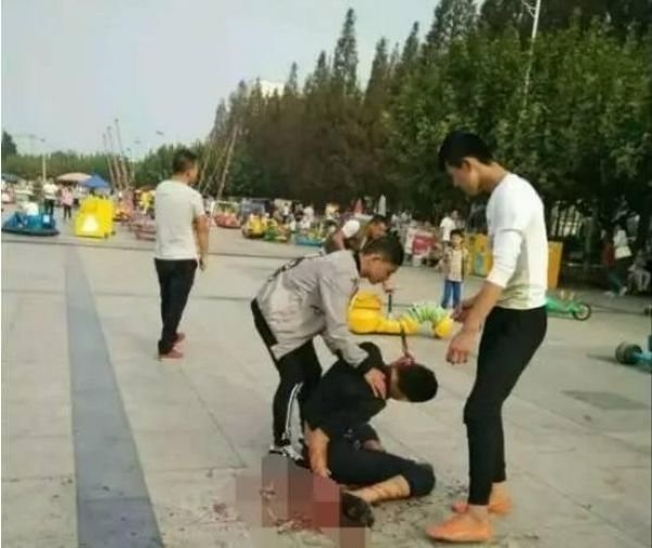Китаец выжил после удара ножом в голову, Шокирующие Фото